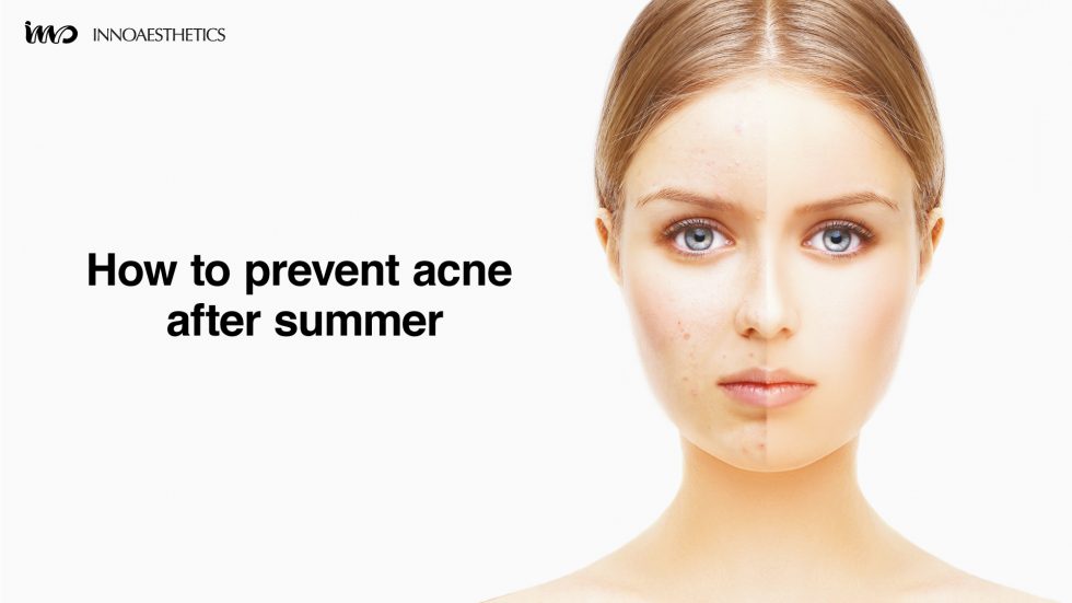 HOW TO PREVENT ACNE AFTER SUMMER INNOAESTHETICS
