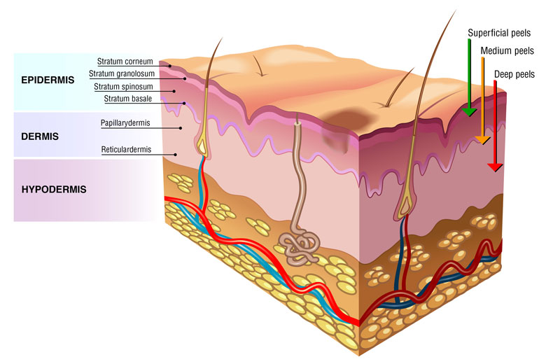 Skin Lyers_BL001_PostChemical Peels Skin Lyers_BL001_PostChemical Peels