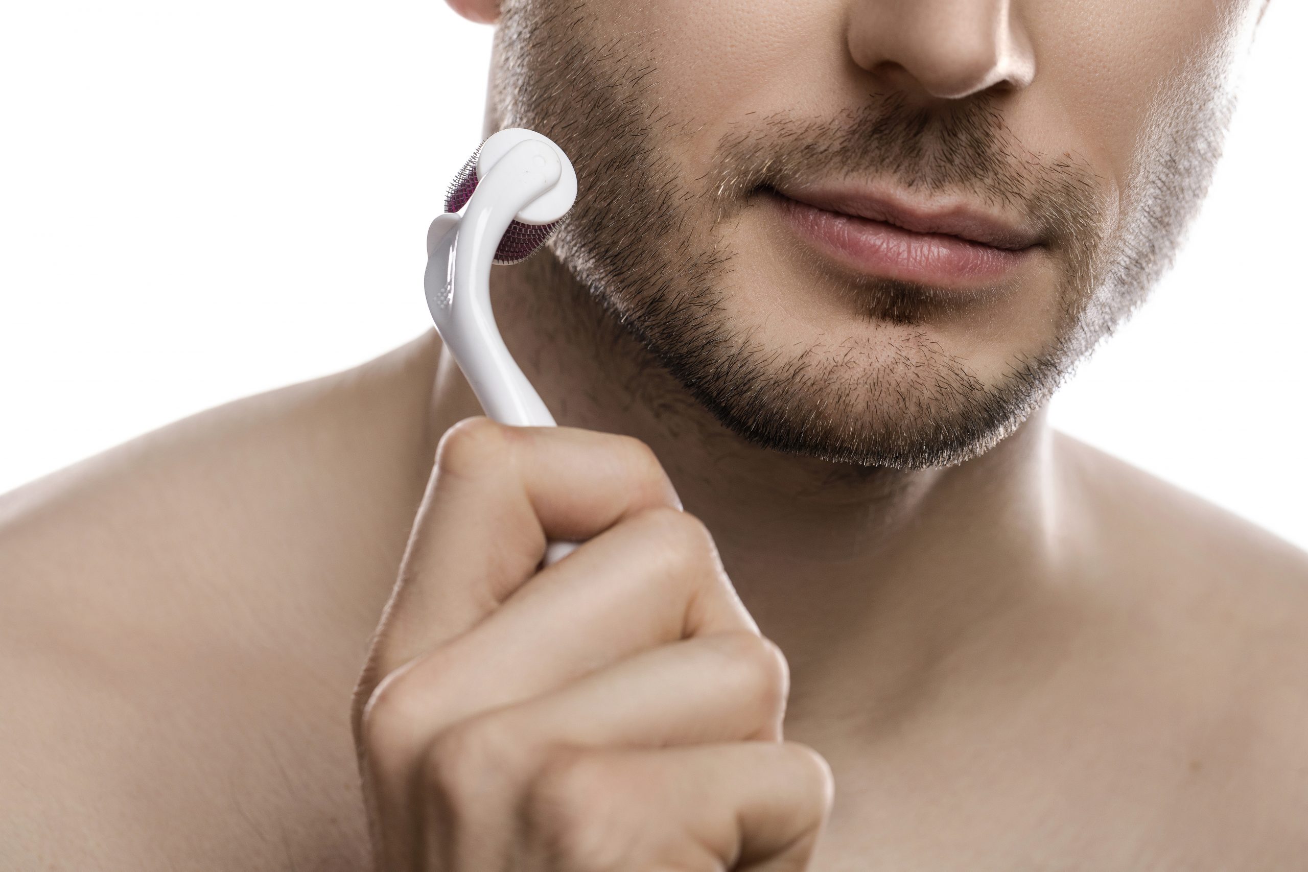Young,Handsome,Man,Is,Using,Derma,Roller,For,Beard,Growth