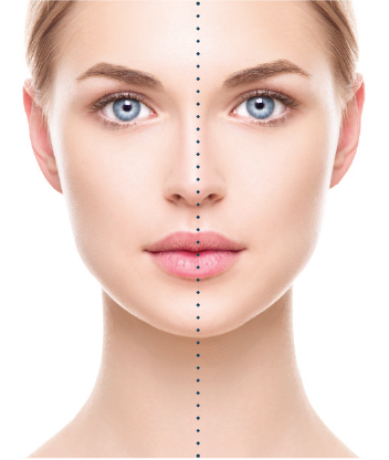 Facial application reference for VPA Technique®