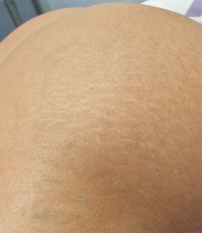 Before treatment
