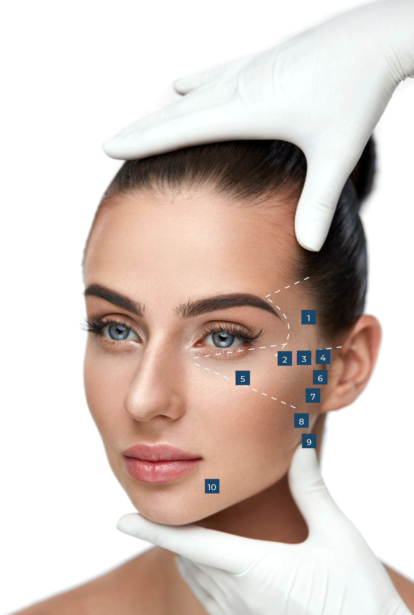 Injection points facial map