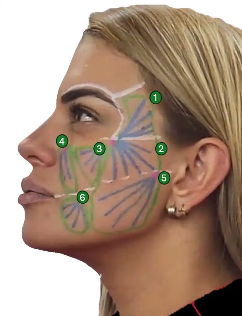 Facial adipostructuring illustration