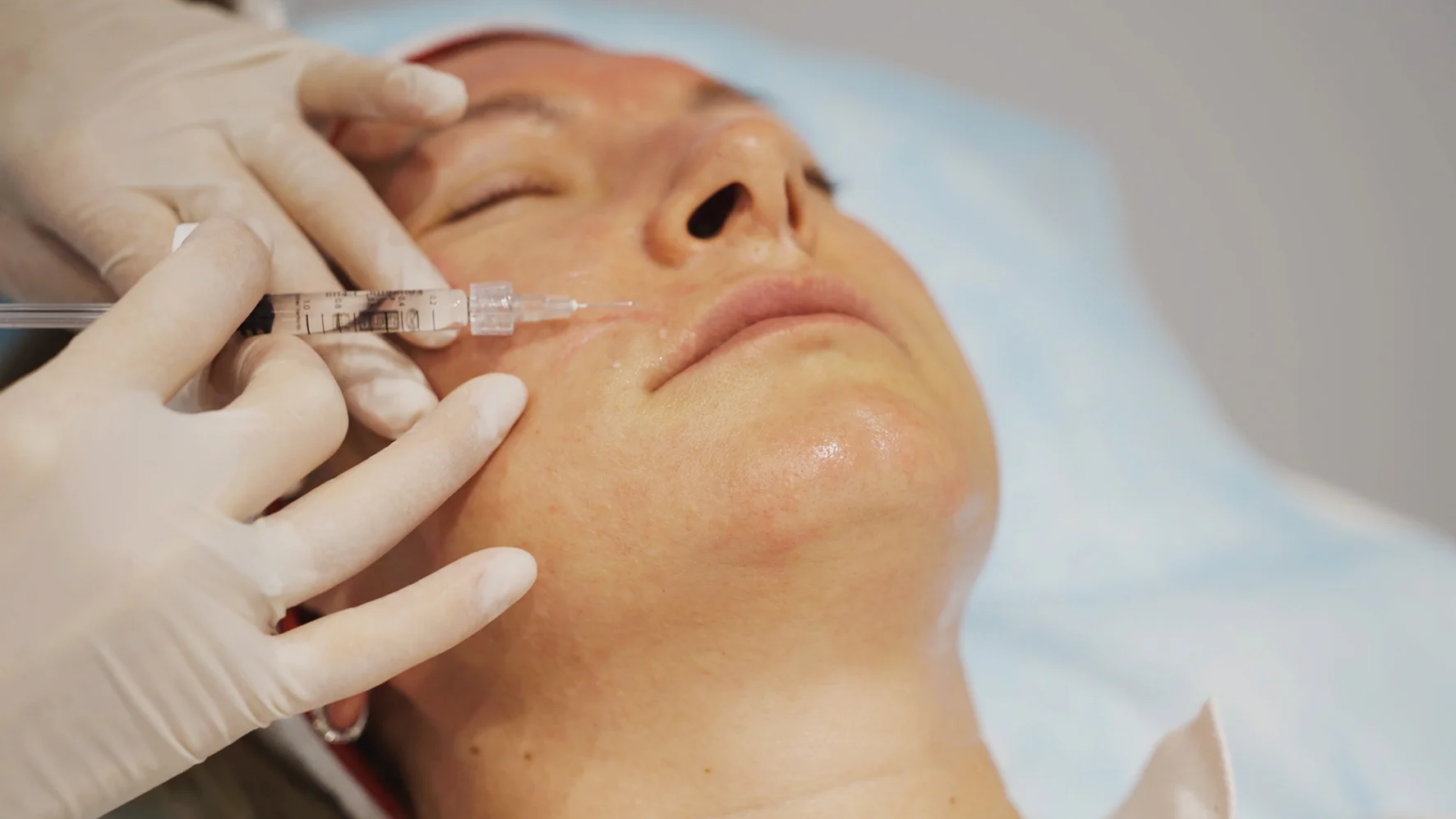 Scar correction