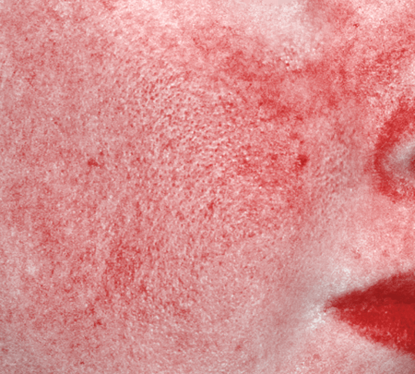After treatment result 2